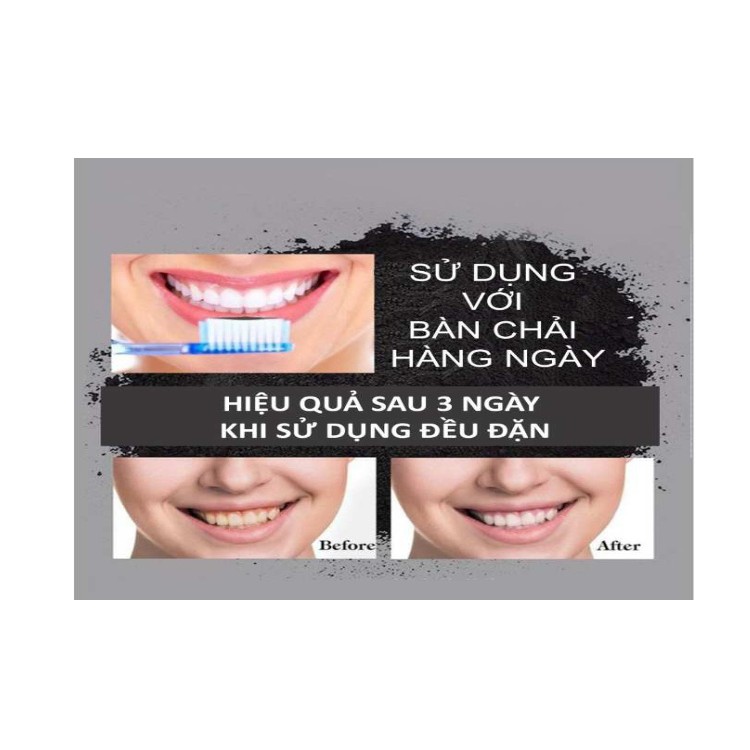 Bột tẩy trắng răng than hoạt tính Teeth Whitening 30g