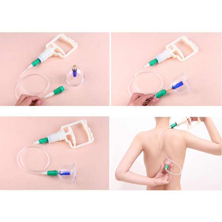 Bộ giác hơi chân không 24phụ kiện, giác hơi toàn thân không dùng lửa tại nhà