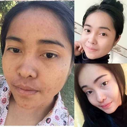 Kem dưỡng da Demejine Hàn Quốc 20g ban đêm loại bỏ mụn nám tàn nhang dưỡng trắng hồng mịn màng