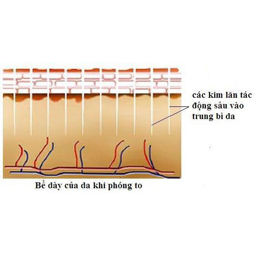 Cây lăn kim trị sẹo chăm sóc da mặt 0.5cm