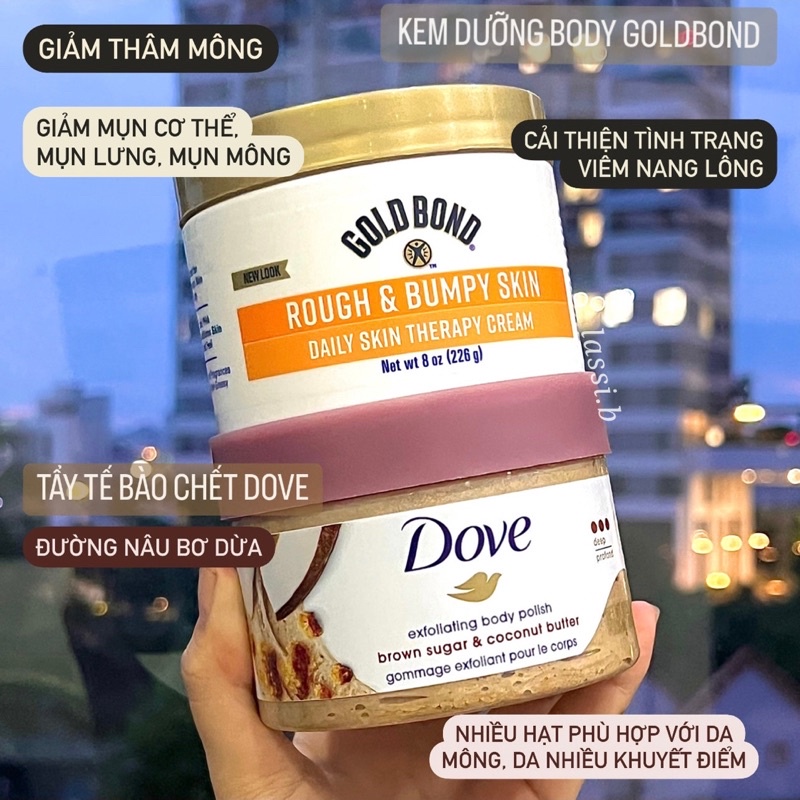 Kem dưỡng Gold Bond Rough&Bumpy Skin dành cho da sần sùi, da gà, viêm nang lông