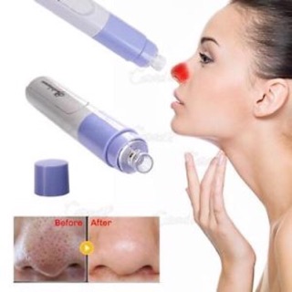 Máy Hút Mụn Mini Spot Cleaner (Xanh)