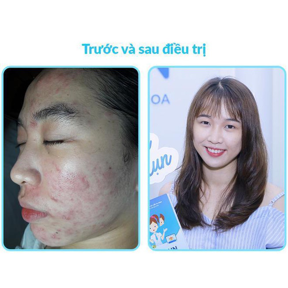 Kem Ngừa Mụn, Giảm Thâm,Giảm Bóng Nhờn 50ml - DERMACOS FARMONA | BigBuy360 - bigbuy360.vn