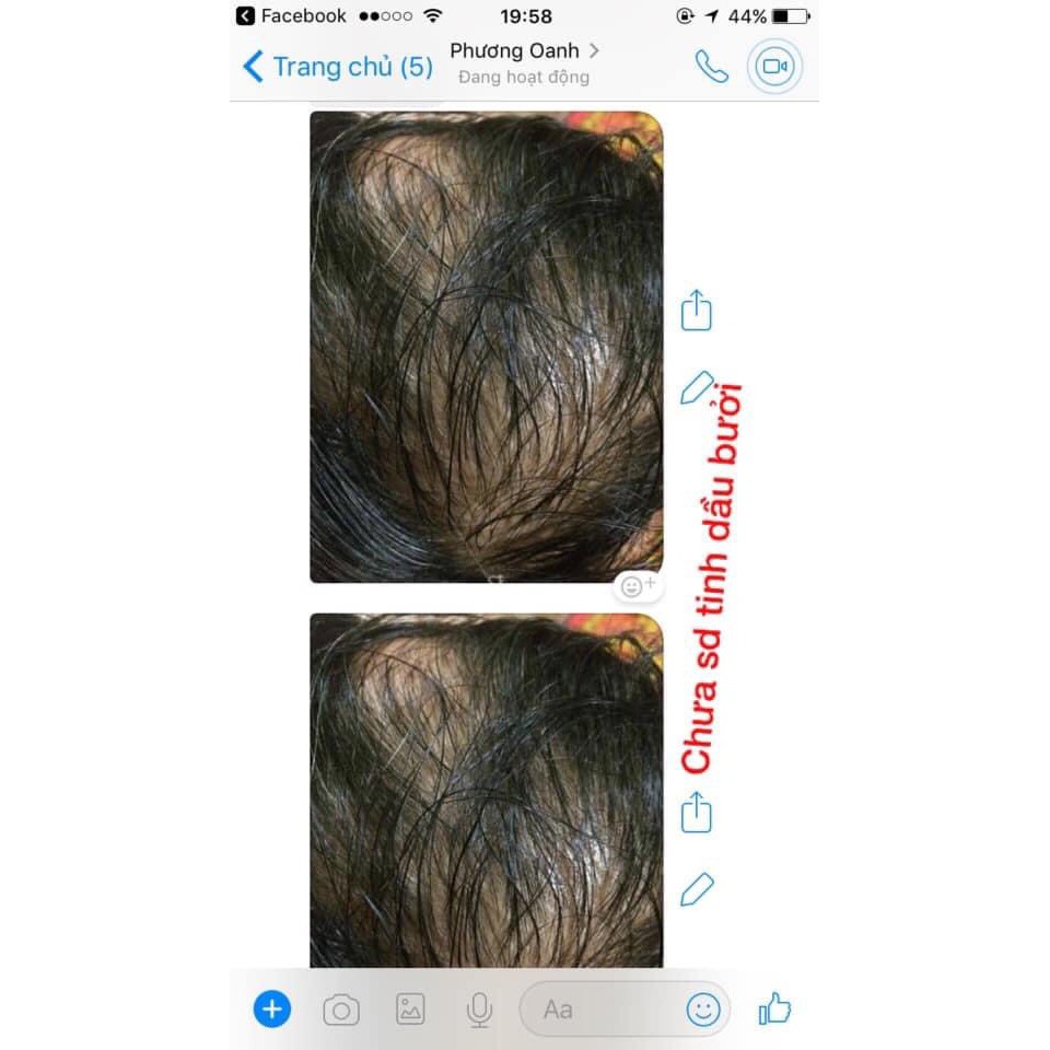 (Tinh dầu bưởi nguyên chất 100%) Giảm rụng tóc, kích thích mọc tóc | BigBuy360 - bigbuy360.vn