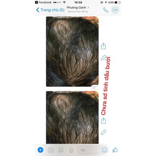 (Tinh dầu bưởi nguyên chất 100%) Giảm rụng tóc, kích thích mọc tóc