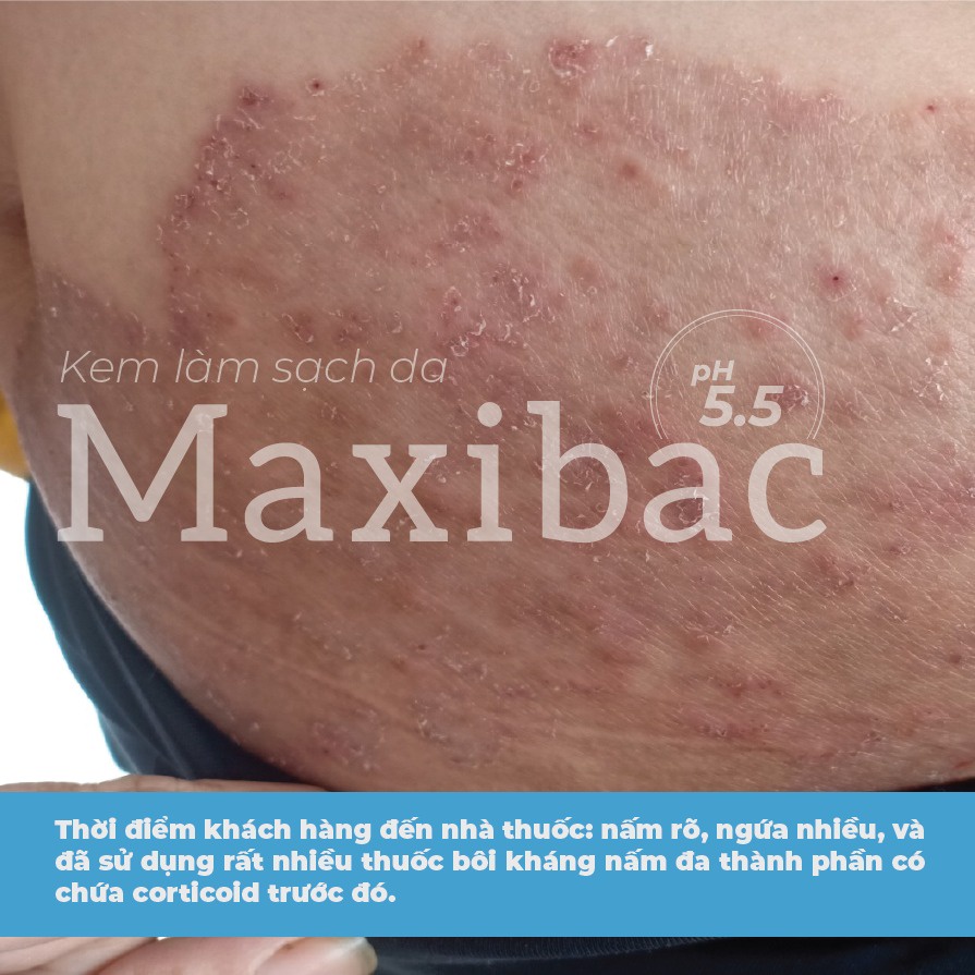 Kem tắm làm sạch da Maxibac pH 5.5 chai 100ml