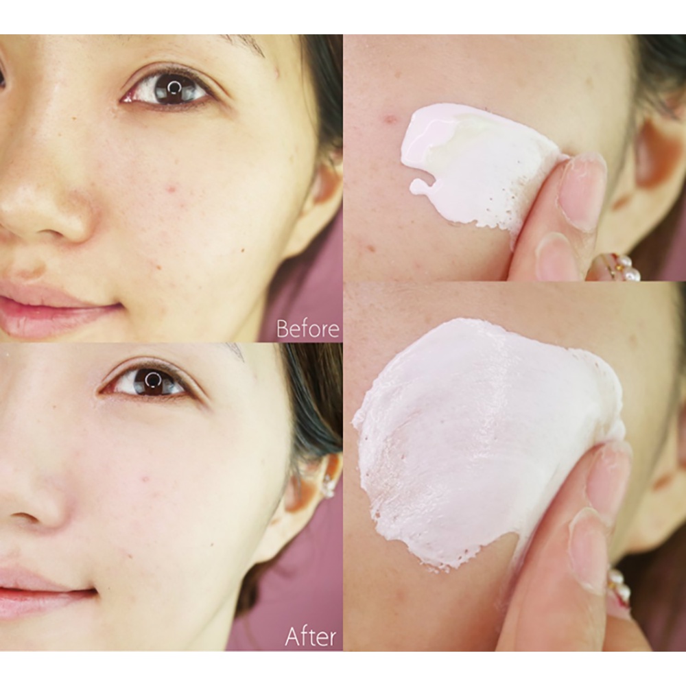 Kem Dưỡng Da Ngăn Ngừa Lão Hóa 3W Clinic Flower Effect Extra Moisturizing Cream 50g