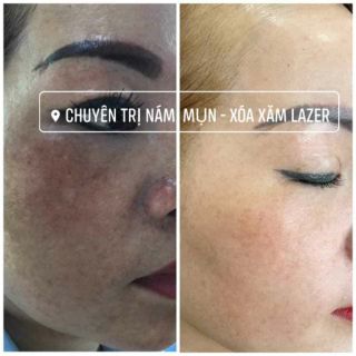 Sữa rửa mặt 2 IN 1 NSK