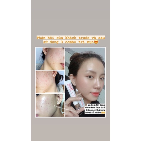 [Chính Hãng] Vaurora | BigBuy360 - bigbuy360.vn