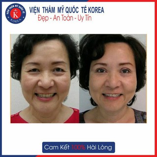 HN[VOUCHER] - NÂNG CUNG MÀY Hàn Quốc hết sụp mí, trẻ hóa toàn diện tại Viện Thẩm Mỹ Quốc Tế Korea