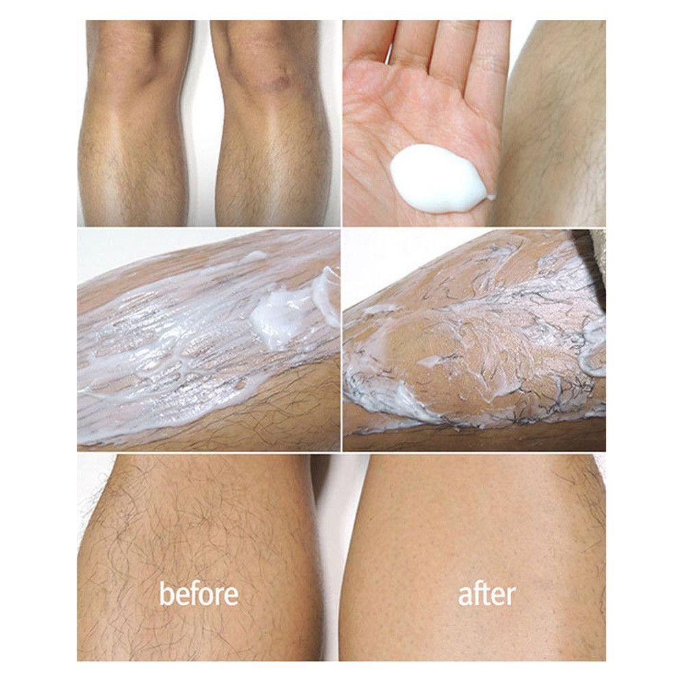 EUTUS Kem Tẩy Lông Không Đau 125ml 125ml Cho Nam Nữ