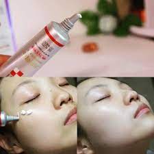 Kem Ngừa Nám Và Tàn Nhang Melasma-X 3D Whitening Clinic Cream mờ nám tàn nhang đ𝐨̂̀𝐢 𝐦𝐨̂̀𝐢 dưỡng ẩm da  tặng máy ion