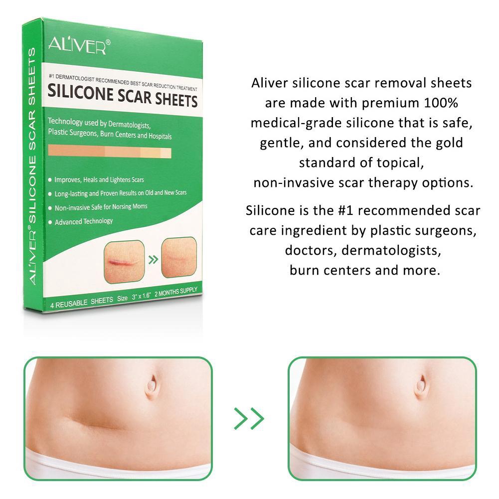 Miếng dán giảm sẹo Aliver K0W4 chất liệu silicon tiện dụng