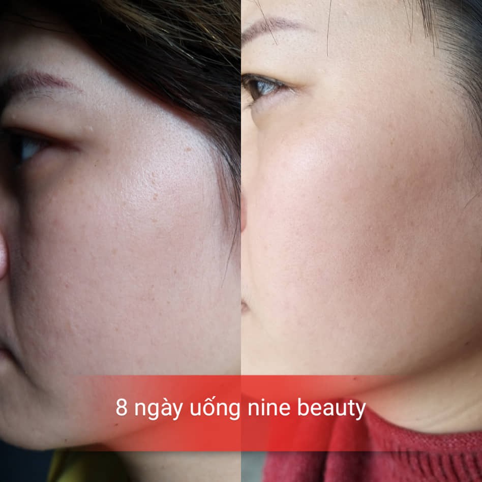 [CHÍNH HÃNG] Viên uống trắng da Nine's Beauty Chống lão hóa Giảm Nếp Nhăn giảm nám tàn nhang, Cân bằng Nội tiết Nines