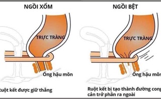Ghế chống táo bón