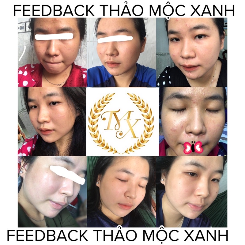 Serum thảo mộc xanh ( 1 lọ )