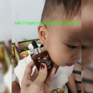 Tinh Chất Bơ 5ml