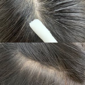 Tẩy tế bào chết da đầu, bông tẩy tế bào chết, làm sạch da đầu Dr.ForHair Folligen easy swab cleansing 6ml