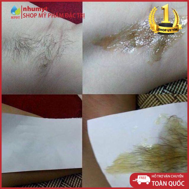 Combo triệt lông vĩnh viễn Wax + Mỡ Trăn. Tẩy lông handmade an toàn tặng kèm bộ dụng cụ wax mới Hàng Mới Cập Nhập