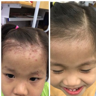 Sữa tắm rôm sảy Tamrom