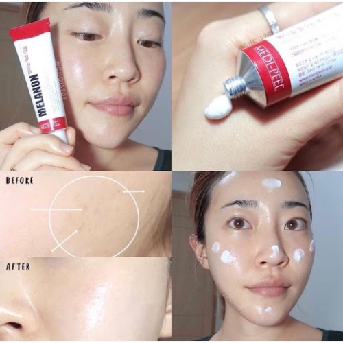 Kem Dưỡng Nám Tàn Nhan Medi-Peel Melanon Cream 30ml ( ĐỎ)