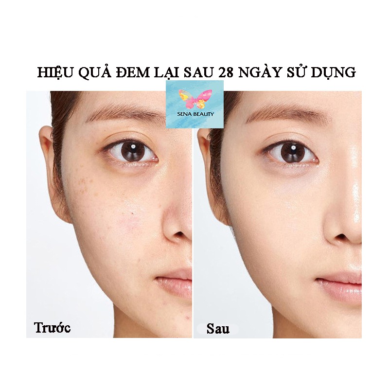 Serum dưỡng trắng da mờ nám tàn nhang Aihegskin Oilyoung Whitening Essence 15ML Senabeauty | BigBuy360 - bigbuy360.vn