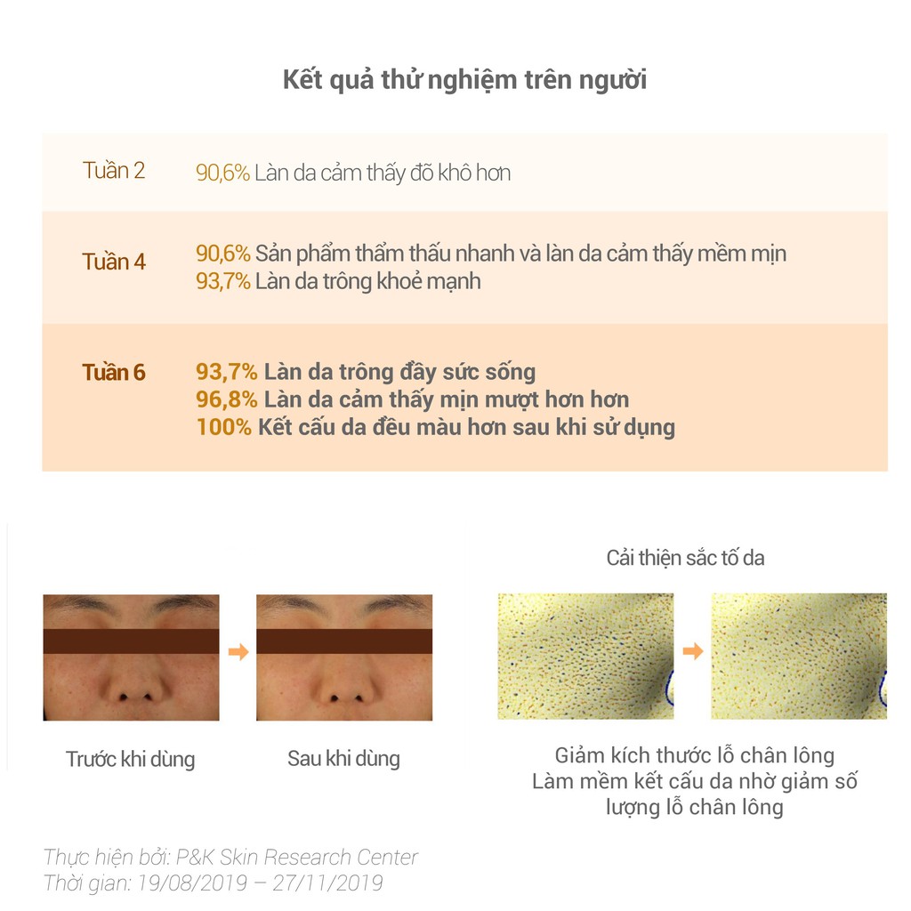 [Mã FMCG100K - 10% đơn 500K] Bộ sản phẩm dưỡng sáng và se khít lỗ chân lông innisfree Brightening Pore Serum Set | BigBuy360 - bigbuy360.vn