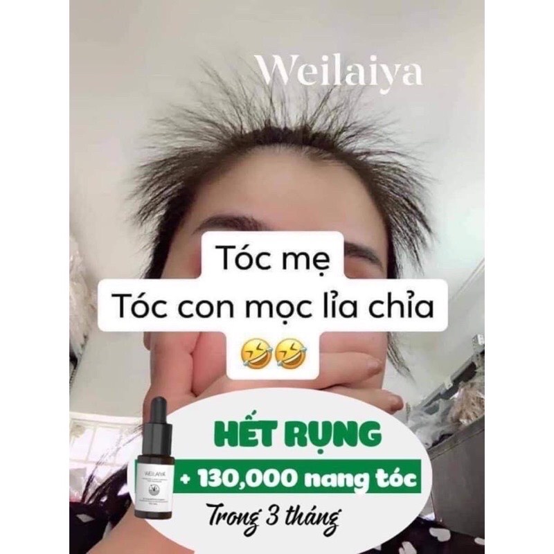 Huyết thanh kích mọc tóc Weilaiya, serum mọc tóc Weilaiya giảm rụng kích mọc hiệu quả