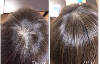 Máy hấp dầu phục hồi tóc tại nhà