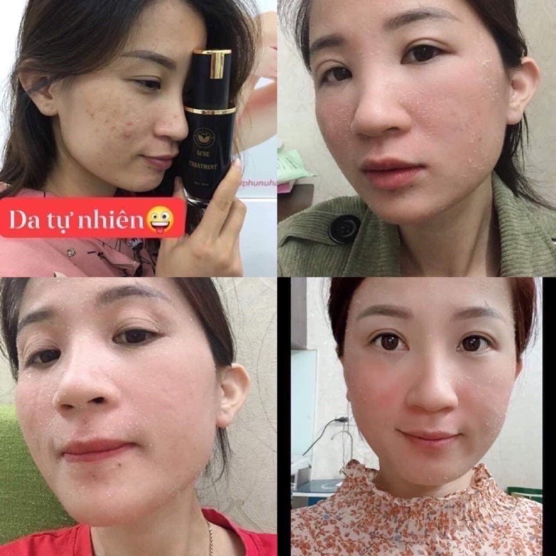 SERUM TÁI TẠO DA NHÂN SÂM TRẦN KIM HUYỀN