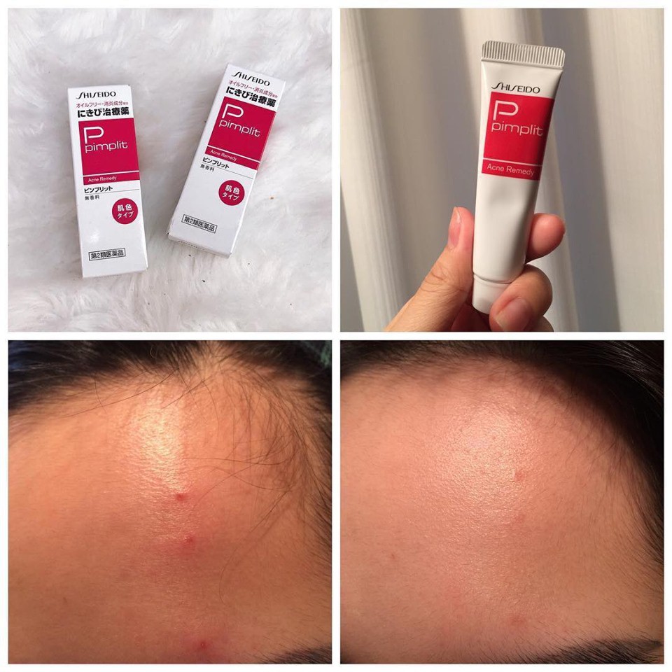 Káº¿t quáº£ hÃ¬nh áº£nh cho Kem trá» má»¥n Shiseido Pimplit Acne Remedy 18g