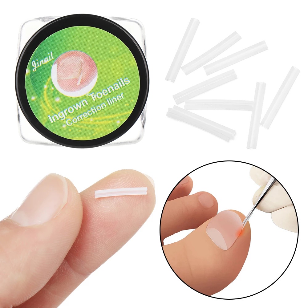 Set 10 Dụng Cụ Chỉnh Sửa Móng Chân / Móng Chân Siêu Mỏng Dùng Một Lần