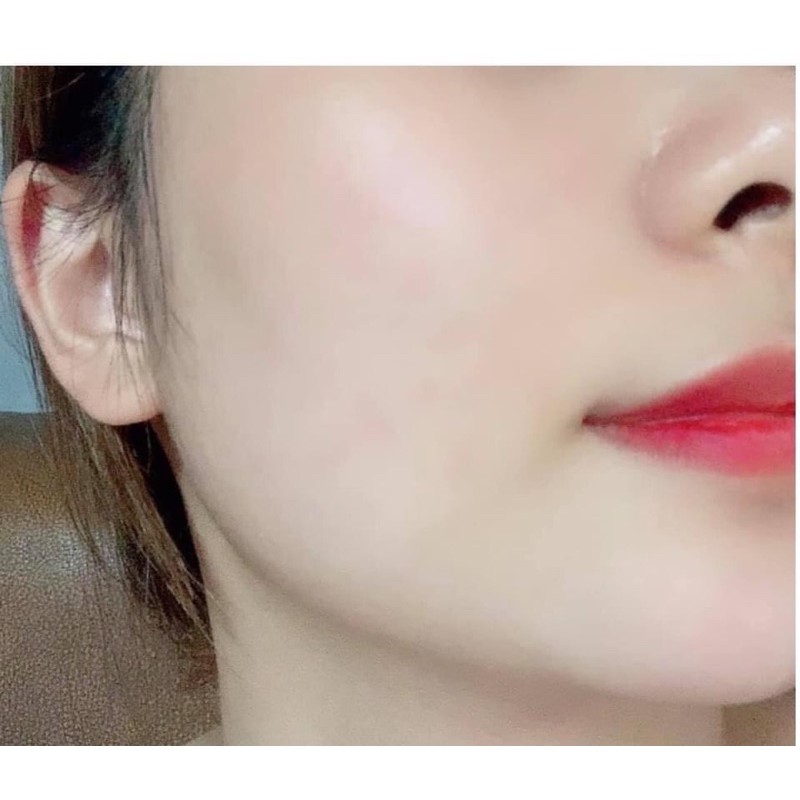 KEM NÂNG TONE #𝐂𝐎𝐒𝐍𝐎𝐑𝐈_𝐖𝐇𝐈𝐓𝐄𝐍𝐈𝐍𝐆_𝐃𝐑𝐄𝐒𝐒_𝐂𝐑𝐄𝐀𝐌 | BigBuy360 - bigbuy360.vn