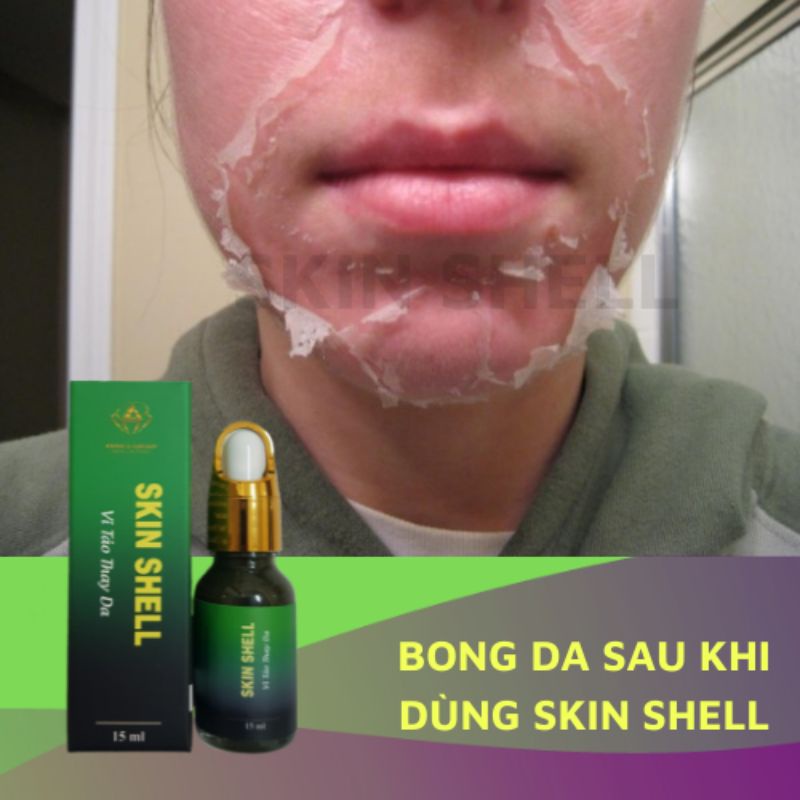 PEEL DA VI TẢO SKIN SHELL