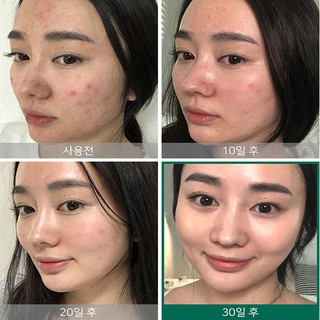 Tinh Chất Some By Mi AHA-BHA-PHA 30 Days Miracle Serum