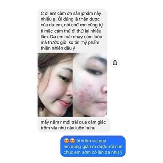 Mặt nạ diếp cá trị mụn Ả Đào