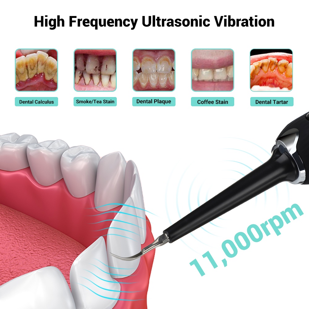 Máy cạo vôi răng tần số cao điện siêu âm bằng điện tiện dụng để vệ sinh chăm sóc răng miệng hiệu quả