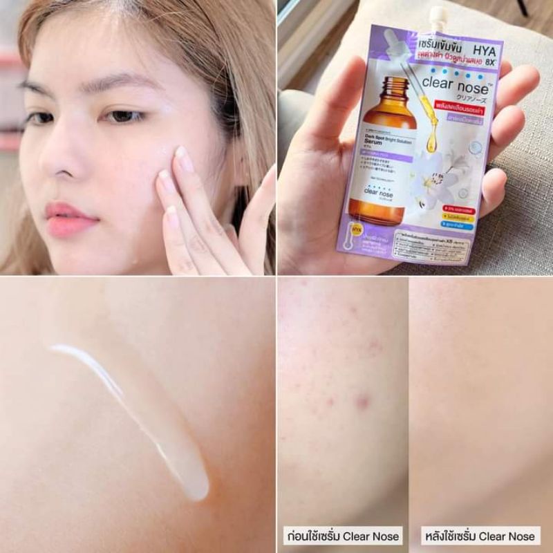 Các Tinh chất và kem BB , Clear Nose😍1 gói 8g.