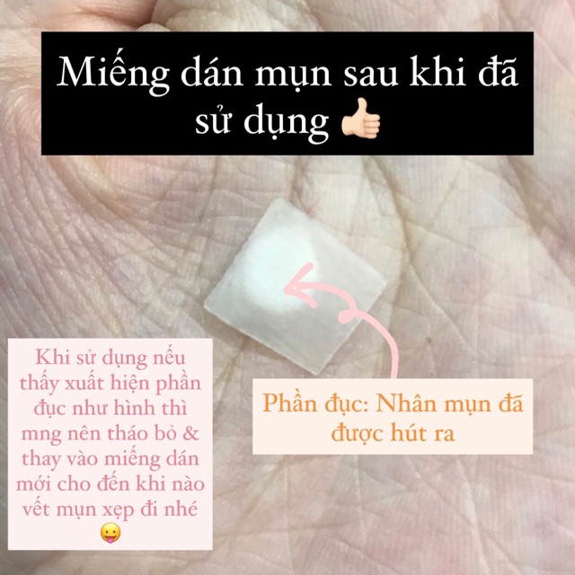 Miếng dán mụn - vết thương Somaderm-L