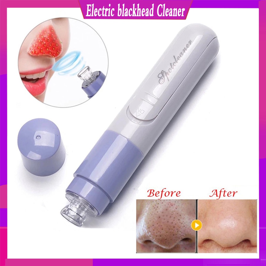 Loại bỏ mũ đen/ Máy hút bụi khuôn mặt