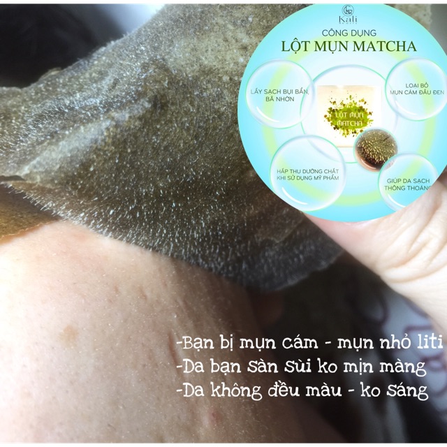 LỘT MỤN TRÀ XANH - SẠCH SÂU LỖ CHÂN LÔNG - TẨY TBC - SẠCH MỤN