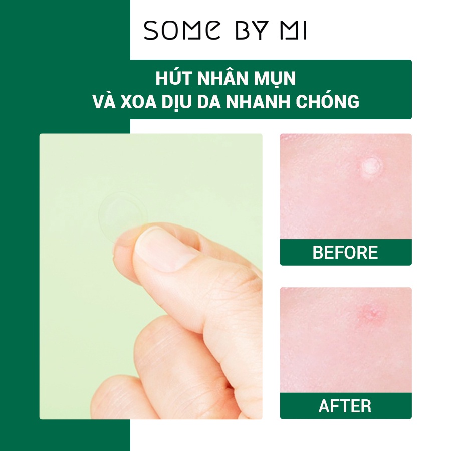 Miếng dán mụn Some By Mi Clear Spot Patch 18 miếng, giảm mụn.