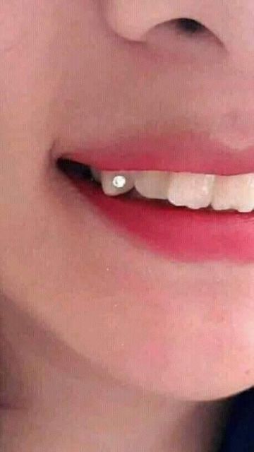 Đá đính răng 2k/viên