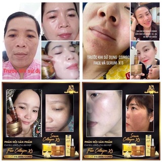 [Chính hãng] Serum Collagen X3