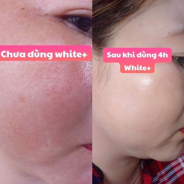 Viên uống trắng da, mờ nám, trị mụn white+++ | BigBuy360 - bigbuy360.vn