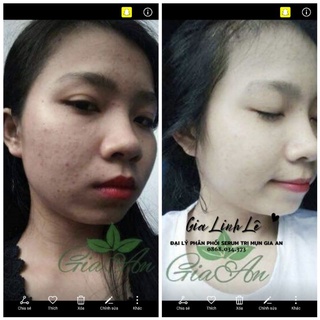 Serum Gia An