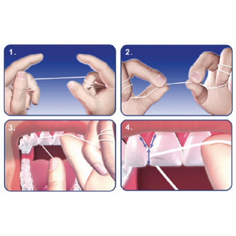 Chỉ Nha Khoa Dentana từ sợi PTFE an toàn cho Răng và Lợi