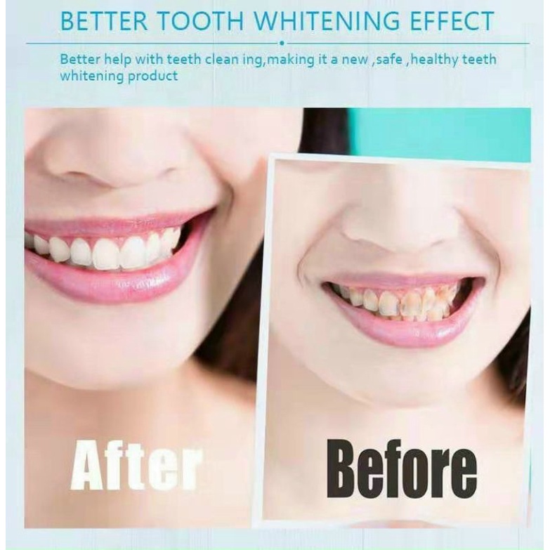 Hộp 7 Gói 2 miếng dán trắng răng tiện lợi 3D White Teeth Whitening Strips