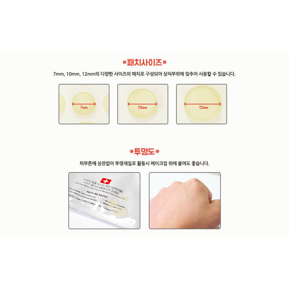 Miếng Dán Mụn Cosrx Acne Pimper Master Patch | BigBuy360 - bigbuy360.vn