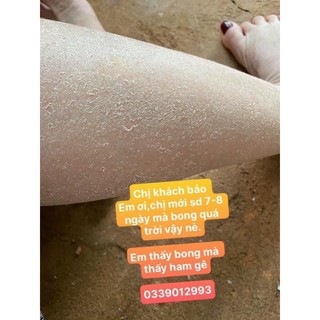 Body Bong Da Vi Hạt